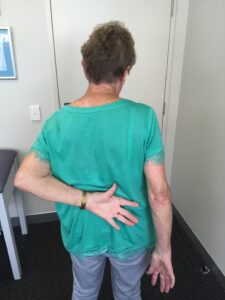 Patient showcasing their range of motion during their recovery