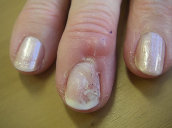 Let's talk about weak/damaged nails! Q&A | Damaged nails, How to grow nails,  Nail bed damage