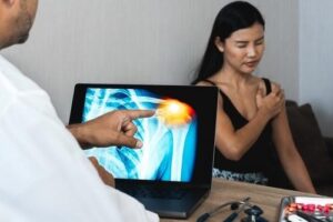 Doctor examining a x-ray of their patient with a shoulder injury. 