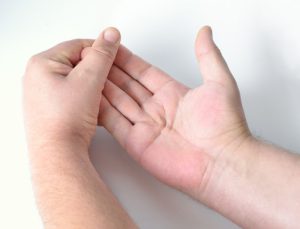 Dupuytren's Contracture Exercises