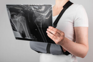 shoulder x-ray